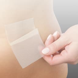 Scar Repair application-Scar Repair application belly