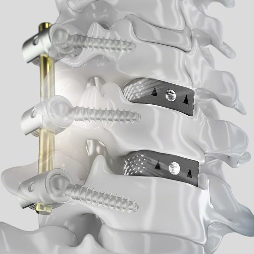 CeSPACE® 3D-Product Picture CW Enlargement