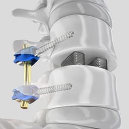 PROSPACE® 3D-Product Picture CW Enlargement