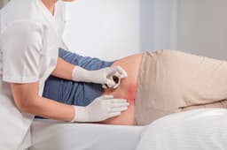 Linovera® 30ml application-Application on non-blanchable Erythema