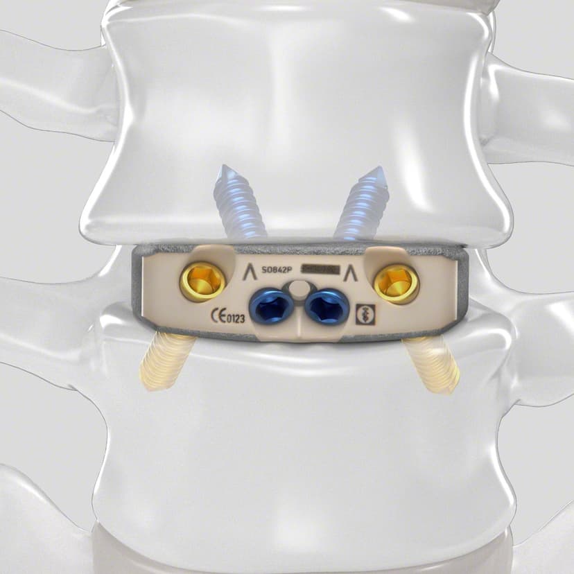 Arcadius XP L®-Product Picture