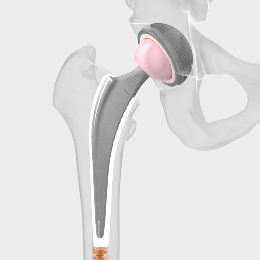 Excia® T-Product Picture