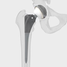 Bicontact®-Product Picture